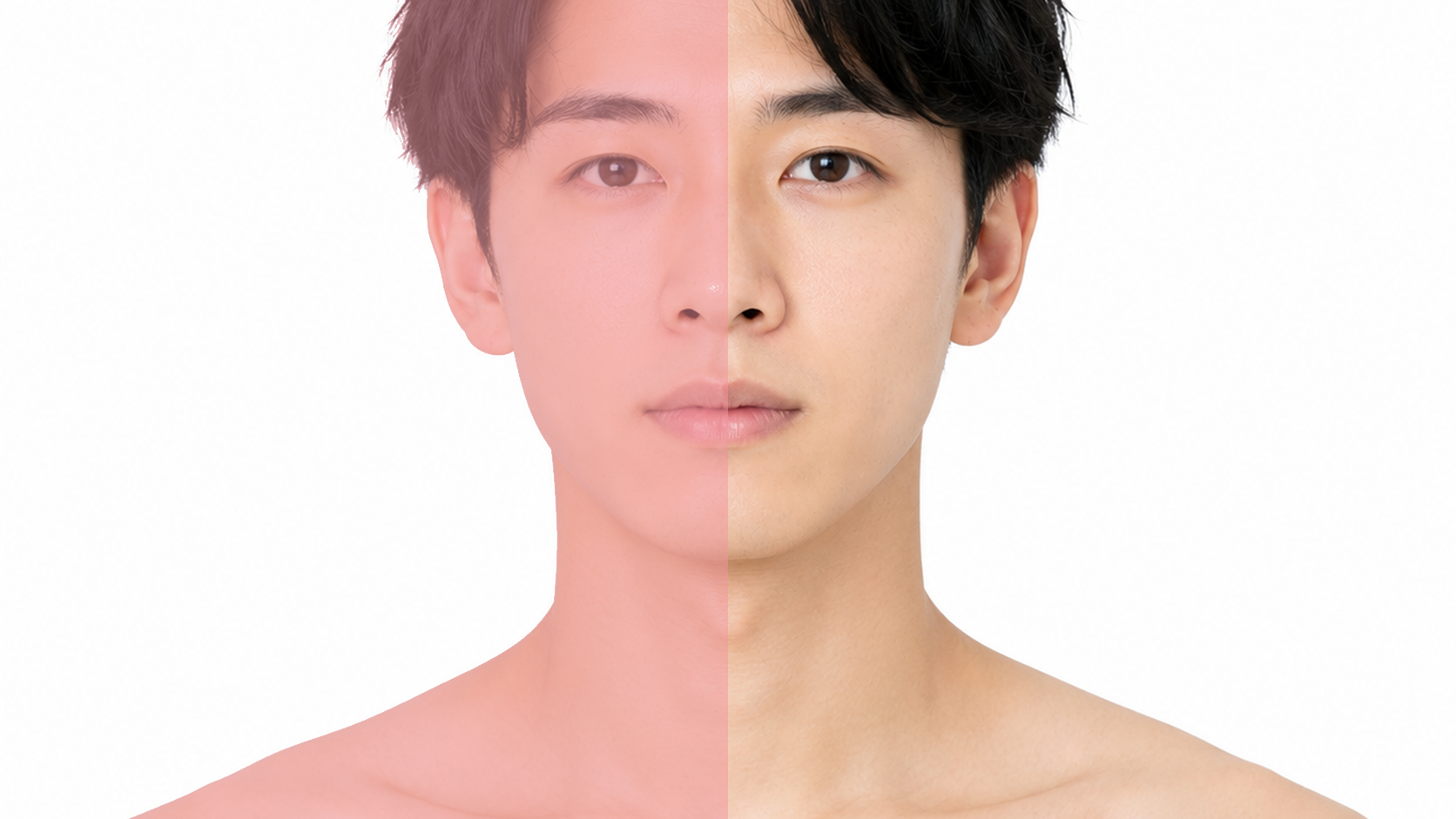 メンズひげ脱毛 脱毛範囲