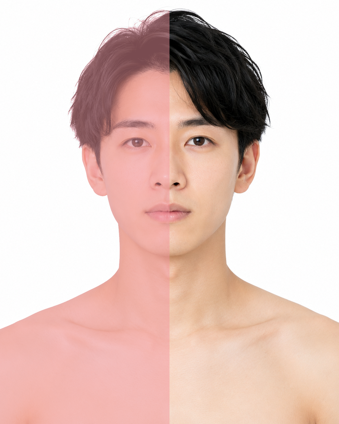 メンズひげ脱毛 脱毛範囲
